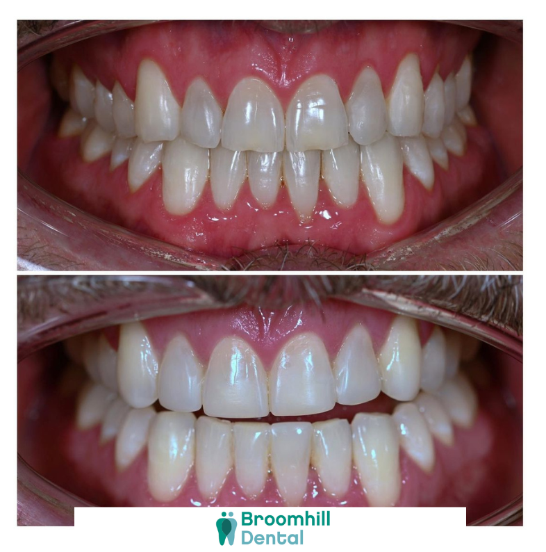 Broomhill Dental