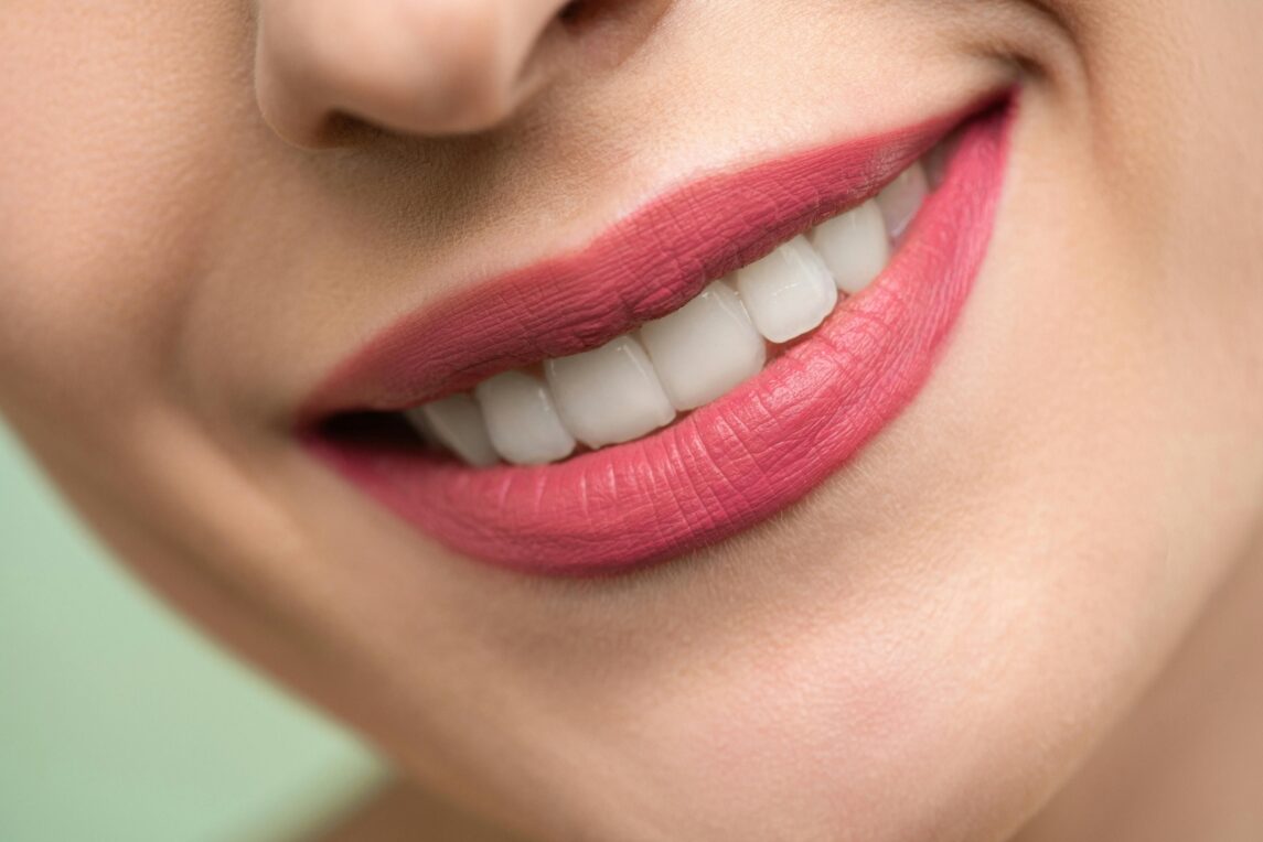 Woman smiling with naturally white teeth